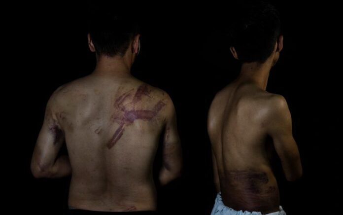 Selama bulan September dan Oktober, terdapat ebih dari 30 kasus kekerasan dan ancaman kekerasan terhadap jurnalis Afghanistan. Foto: AP Foto.