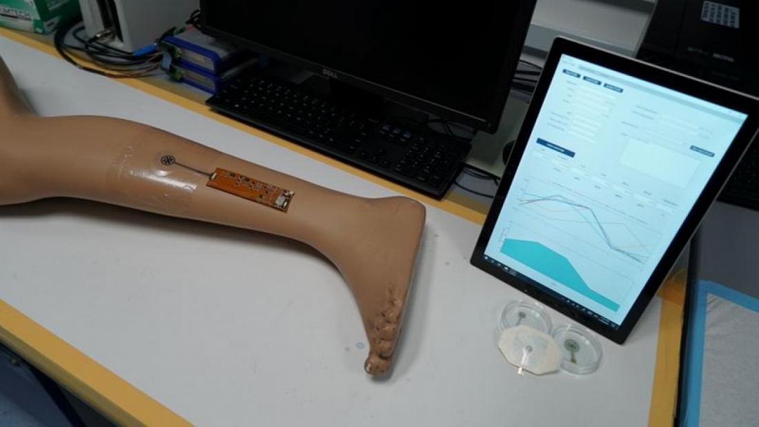 Singapura Uji 'Perban Pintar' untuk Perawatan Luka Jarak Jauh