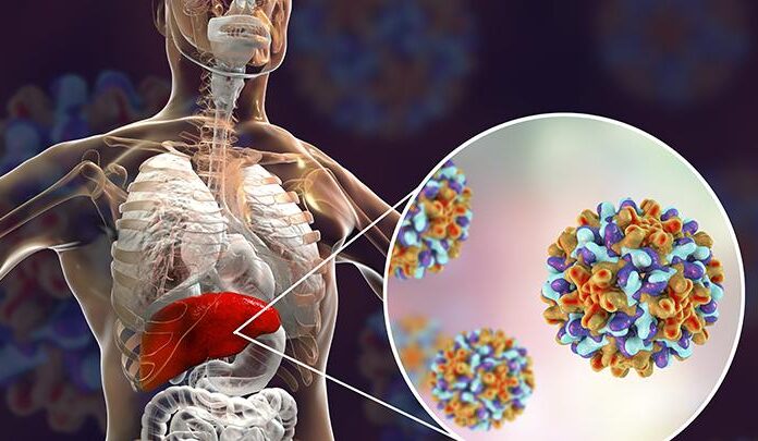 Kemenkes Waspadai Penemuan Kasus Hepatitis Akut