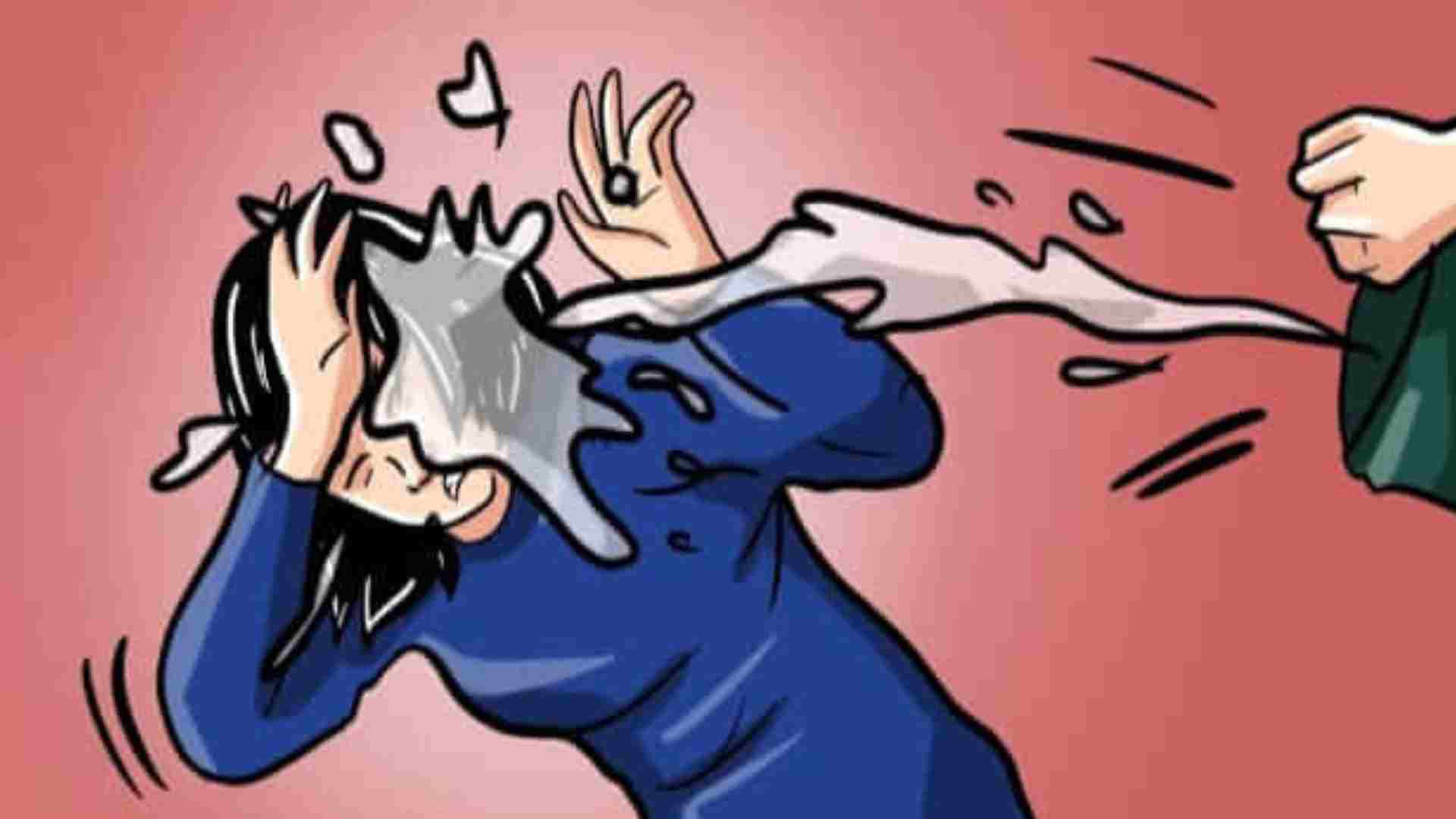 Perempuan di Tuban Disiram Air Keras Oleh Mantan Kekasih, Pelaku Buron